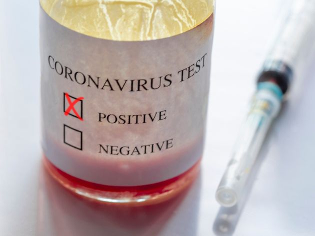 coronavirus test